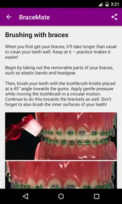 BraceMate android App screenshot 4